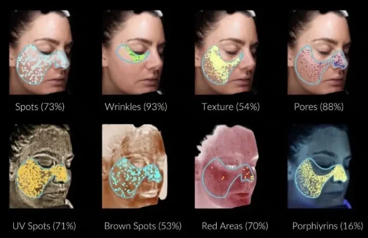 3D AI Skin Analysis Cape Town