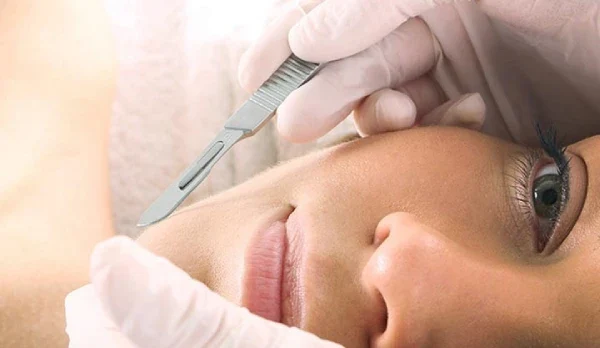 Dermaplaning Cape Town 2