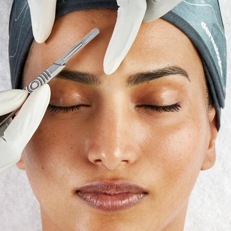 Dermaplaning Treatment Cape Town