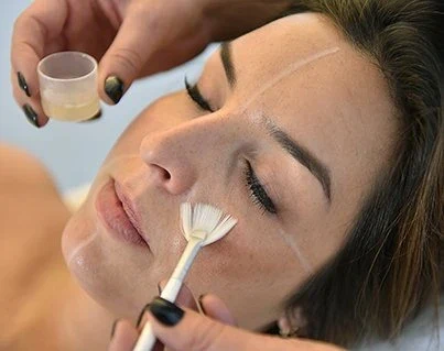 Droxy Peel Cape Town