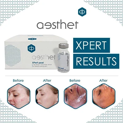 Essel Xpert Peel Cape Town