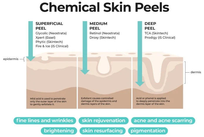 Glycolic Facial Cape Town