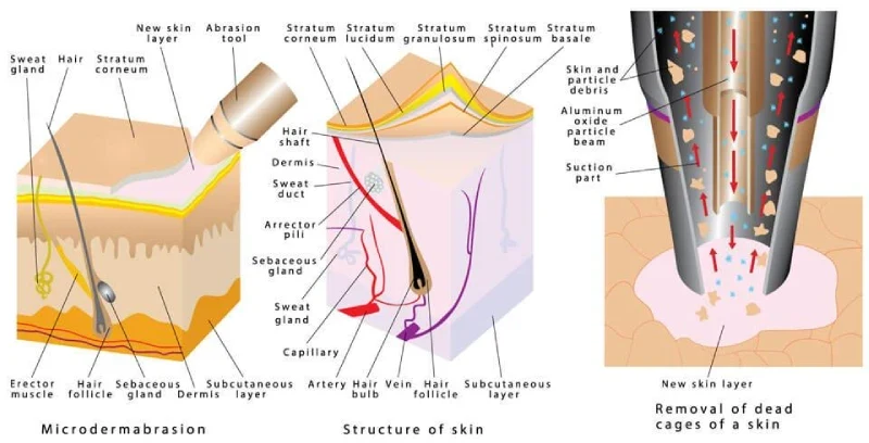 Microdermabrasion Cape Town