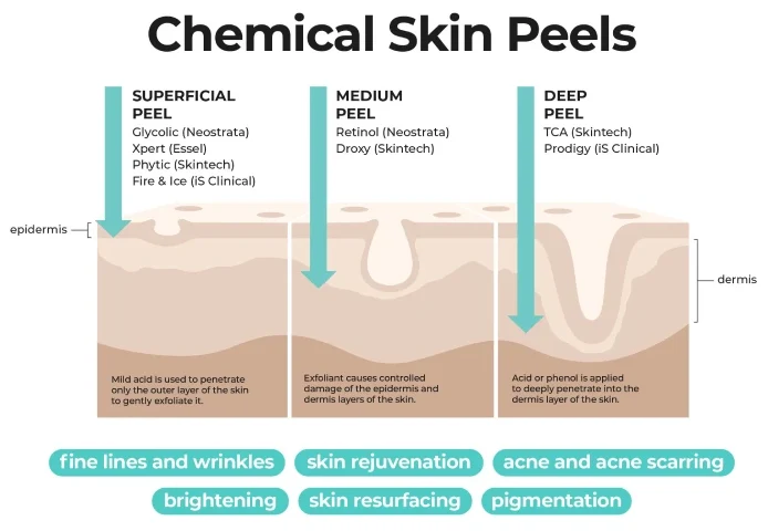 NeoStrata ProSystem Retinol Peel