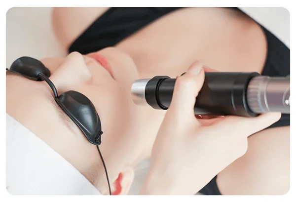Picosecond Laser Cape Town
