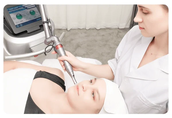 Picosecond Laser Cape Town